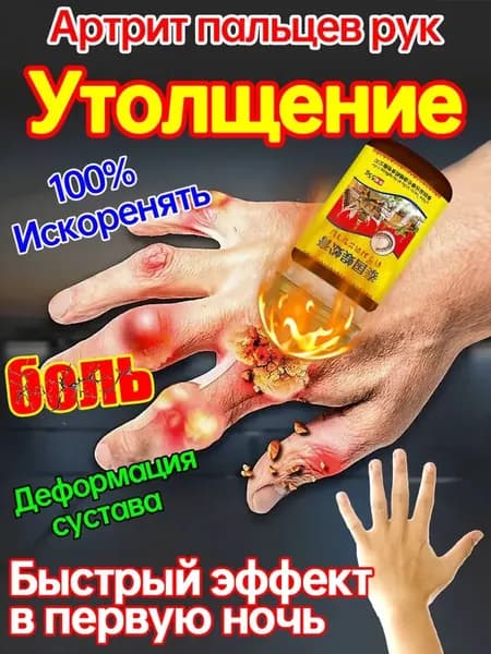 Мазь от подагры,Устранение боли при артрите, коленях, пальцах ног и т. д, на ноге и для рук и артрита 55 г