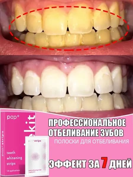 Пластыри для отбеливания зубов, подходят для удаления пятен от кофе и чая, быстро отбеливают зубы, упаковка из 14 штук, курс на 7 применений.