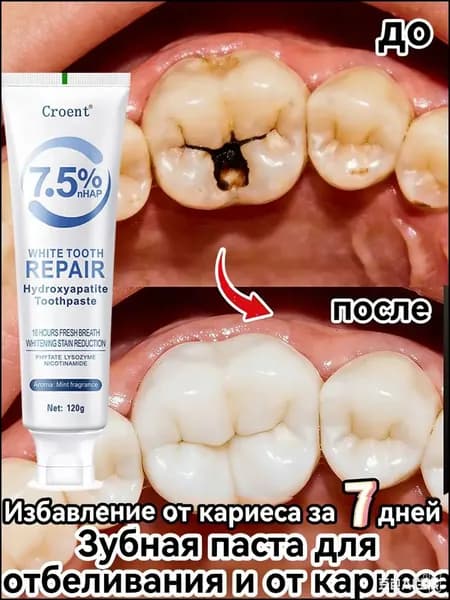 Зубная паста отбеливающая для чувствительных зубов Удаление зубного камня и восстановление зубной эмали