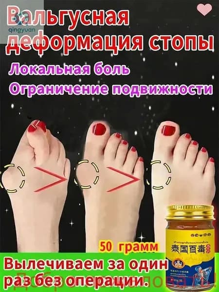 Легендарный тайский крем от косточки на ноге
