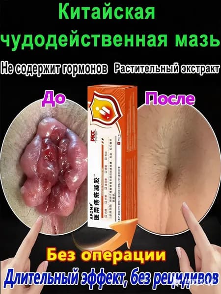 Китайская чудо мазь от геморроя, 100% натуральная, лечит геморрой и анальные трещины, снимает боль, уменьшает отек и дискомфорт, как для мужчин, так и для женщин, 20 г.