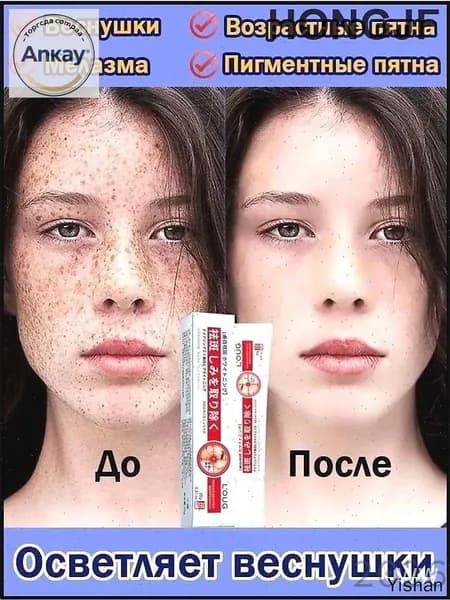 Отбеливающий крем от пигментных пятен и веснушек 20 г,для комплексного ухода кожи осветляющий скрывает пигментацию, веснушки и постакне, против пигментных пятен, защищает от солнечных лучей