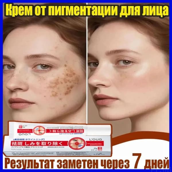 Эксклюзивный антивозрастной крем Ахромин с ретинолом и вытяжкой центеллы, предназначенный для осветления гиперпигментации и пигментных пятен, применяется для устранения черных точек. pengfeishangmao