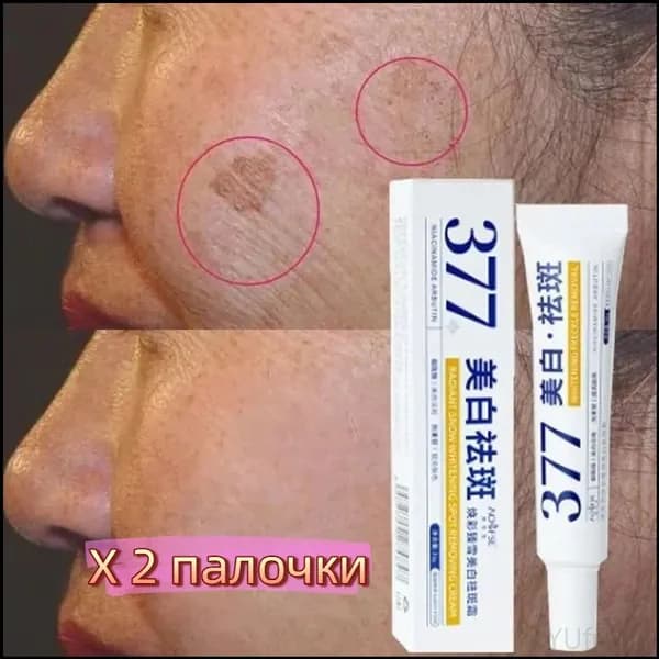 Качественный крем с формулой 377 для осветления, 30 г, две единицы, безопасно устраняющий веснушки, пигментацию и следы акне, рекомендован даже для чувствительной кожи