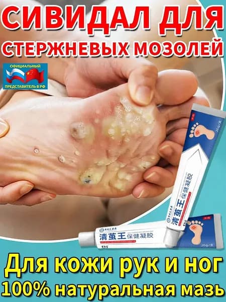 Инновационный бестселлер для устранения стержневых мозолей и натоптышей на ногах, китайская мазь 20 г
