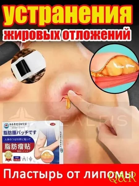 Пластыри от липомы/Быстрое устранение липомы, прыщей, лимфаденита и т Шишка в области подмышек12 шт/коробка