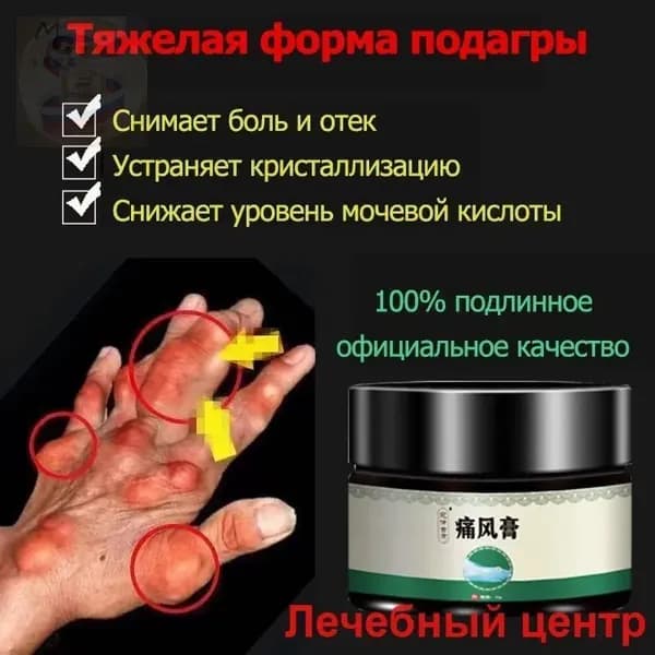 Мазь для суставов обезболивающая, Бальзам от подагры, артрита, ревматизм, мышечных суставов и пальцев