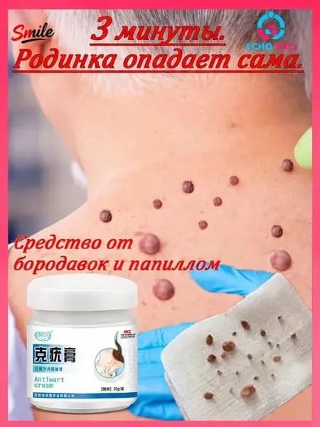 Мазь от папиллом и бородавок, средство для удаления шипиц, наростов, кожных образований 20 г