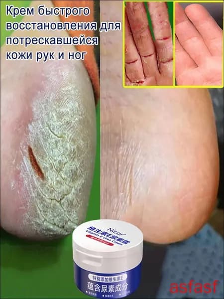 Крем Мазь от трещин для сухой кожи ног и рук, заживление, ,восстанавливающий и увлажняющий для грубой рук