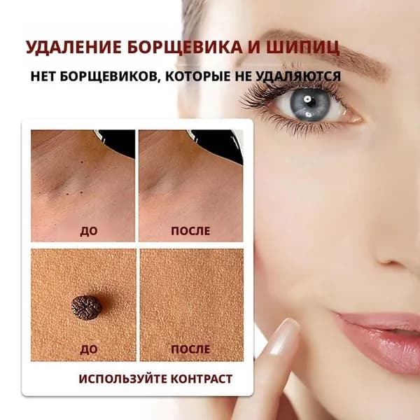 Суперчистотело карандаш от папиллом и бородавок 3ml