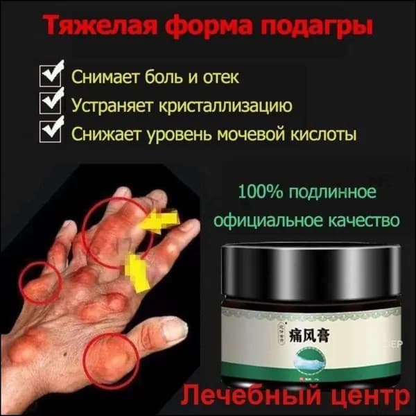 Мазь для суставов обезболивающая, Бальзам от подагры, артрита, ревматизм, мышечных суставов и пальцев