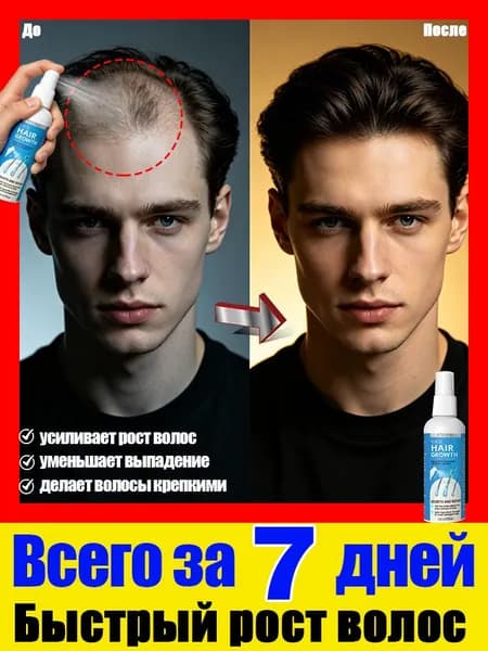 Спрей для роста волос для предотвращения выпадения волос и стимулирования роста, подходит для мужчин и женщин, увеличивает плотность и толщину,90 мл