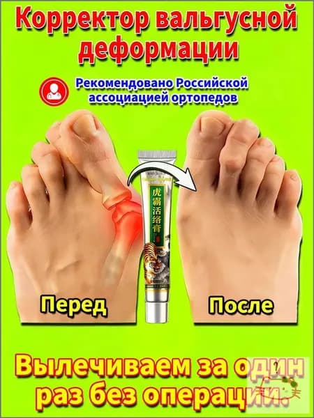 желчь медицинская.Китайская мазь для коррекции вальгусной деформации стопы,подагре и артрите