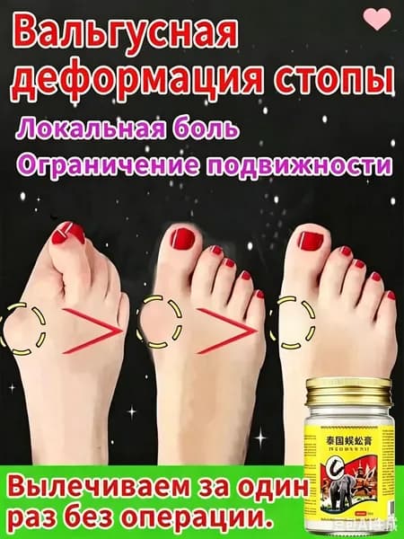 Легендарный тайский крем от косточки на ноге