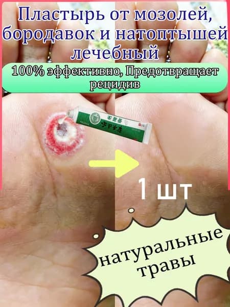 Пластырь от мозолей, бородавок и натоптышей лечебный, быстрое смягчение, безболезненное удаление,20 г 1 шт.