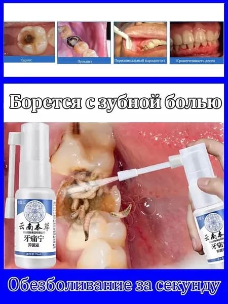 Спрей для лечения зубной боли, при зубной боли, воспалении десен, язвах во рту, снимает боль и отек, 20 мл