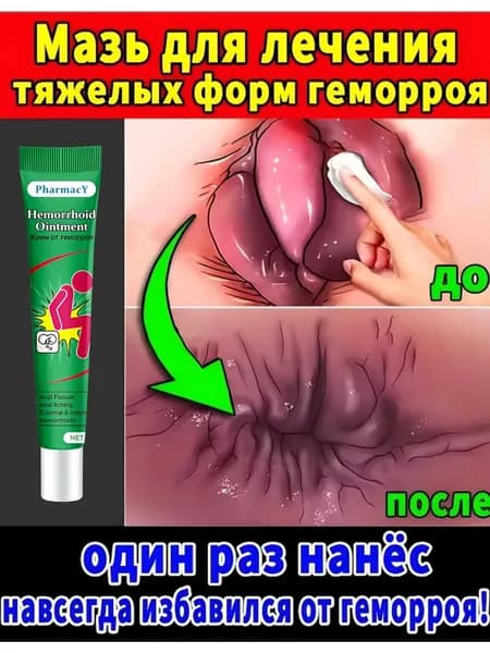 Китайская ЧУДО МАЗЬ от геморроя, 100% натуральная, не гормональная, крем от геморроя Чжи Чуан Гао 15 г