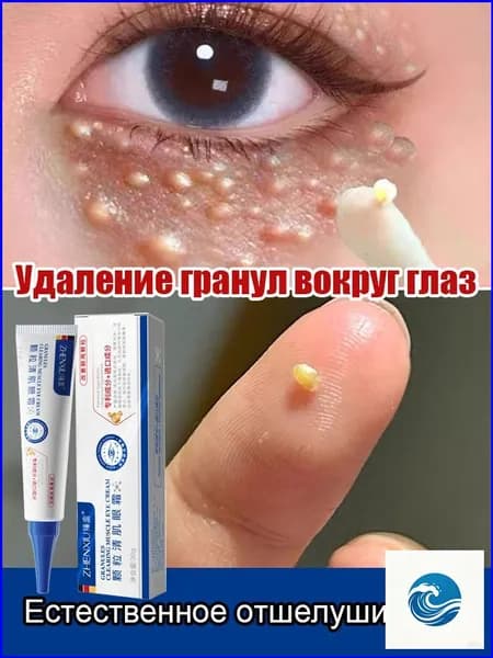 Анти-жировиковый крем для век, устраняет жировики, разглаживает кожу, 30 г