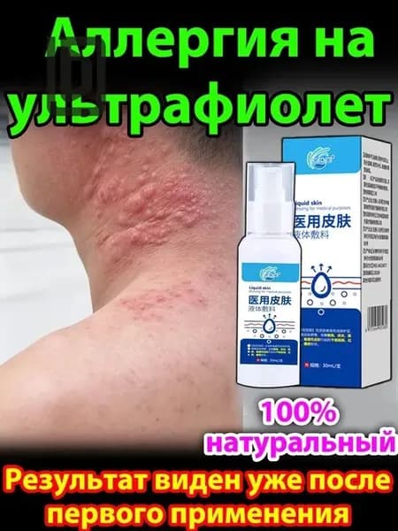 Крем для лечения солнечного дерматита,Восстановление кожи после солнечных ожогов крем после загара