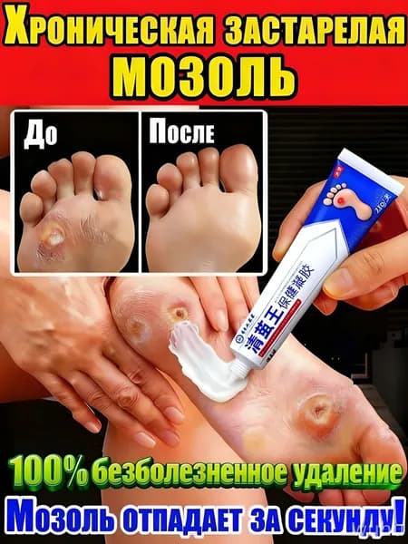 Средство от мозолей, натоптышей, шипиц,мазь от натоптышей китайский китайский,эффективный пластырь для лечения и удаления стержневых мозолей