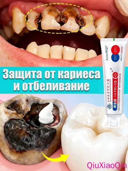 Зубная паста для дырки в зубе, глубокого кариеса и пульпита, Снимает боль, восстанавливает при поражении кариесом у взрослых, Свежее дыхание, 100 г, 1 шт.
