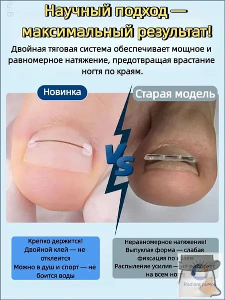 Набор для коррекции вросшего ногтя из никель-титанового сплав