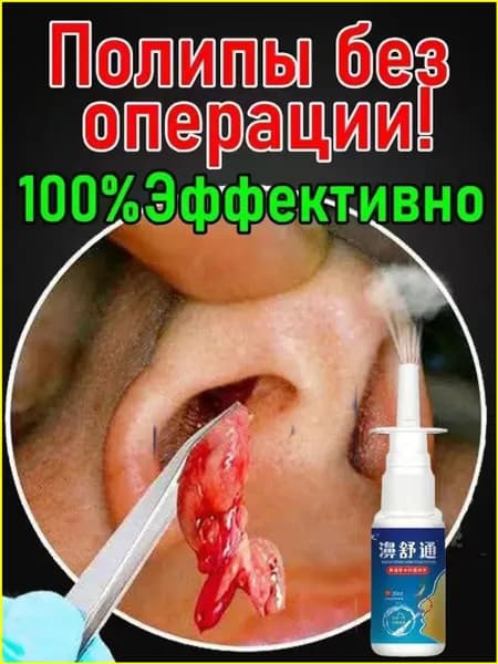Спрей от полипов в носу без операции, 20 мл