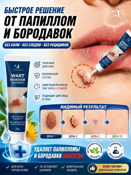 Средство от папиллом крем для удаления бородавок и папиллом, мягко растворяет наросты, безопасно кожи, 20 мл
