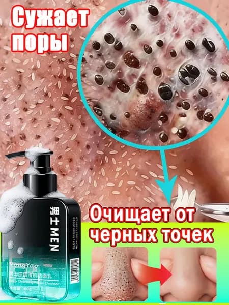 Гель для умывания против прыщей и черных точек для жирной кожи 160г