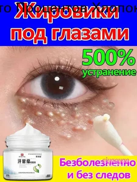 Удаление милиумов под глазами и на веках Быстрое избавление от жировых гранул. Мазь/крем для лечения