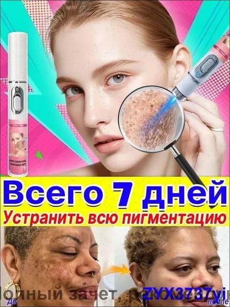 Удаляет пигментные пятна, веснушки, солнечные ожоги, меланодермию, угревую сыпь, морщины.Лазерная указка устраняет пигментацию на лице и теле и отбеливает кожу.1 палочка