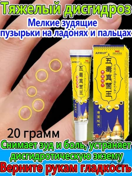 Китайская чудо мазь от псориаза, прыщей, постакне, герпеса, грибка и атопического дерматита. Универсальное негормональное средство для ухода за кожей лица, тела, рук, ног и пяток.