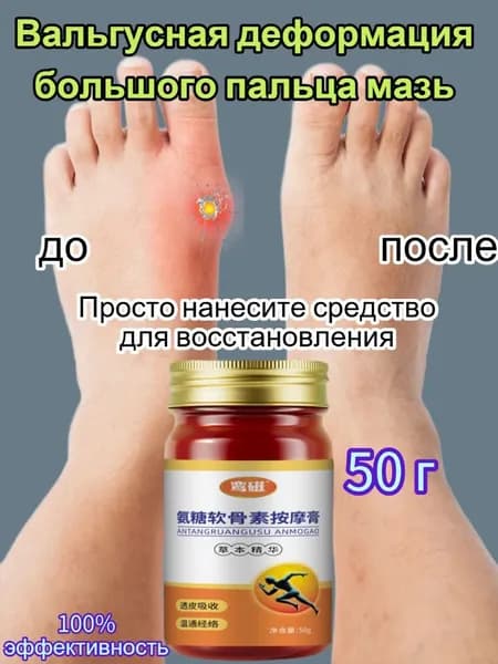 Крем при вальгусной деформации, от шишек на больших пальцах ног,50 мл