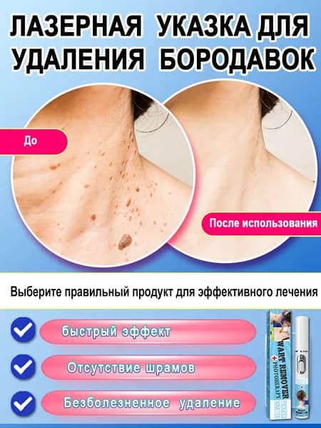 Безболезненное удаление бородавок. Подходит для обычных бородавок, подошвенных бородавок и сарком. Быстро и безболезненно, способствует восстановлению кожи.