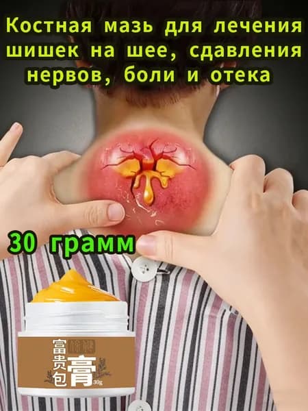 Мазь для шеи и плеч, помогающая вылечить шишки на шее, сдавление нервов, боль и отек, мазь для хрящей при шейном остеохондрозе и остеохондрозе спины, анальгетики