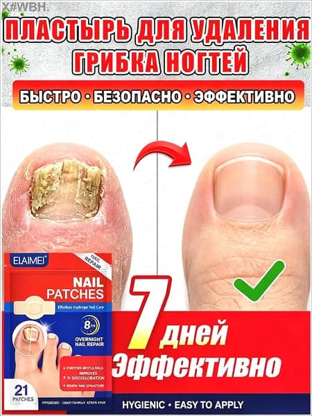 быстро избавляют от грибковых инфекций рук и ног,а также вылечить утолщение ногтей, покраснение, отек, зуд, расслоение 21шт