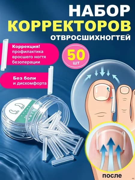 Корректор от вросшего ногтя, вставка для ногтей на ноге