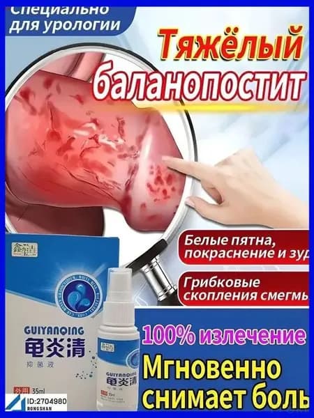 Премиум спрей 35 мл от баланопостита используется для оперативного снятия зудящих ощущений, красноты и жжения у мужчин pengfeishangmao