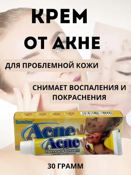 Эффективный крем от прыщей