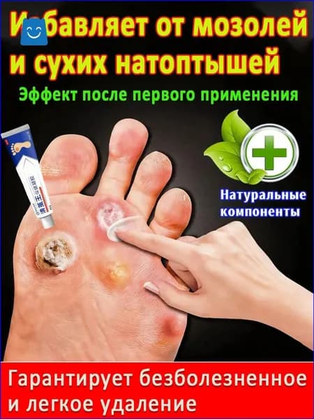 пластырь от натоптышей и стержневых мозолей. от сухих мозолей стержневых, бородавок, натоптышей, шипиц и пяточных шпор.китайская чудо-мазь,20 г
