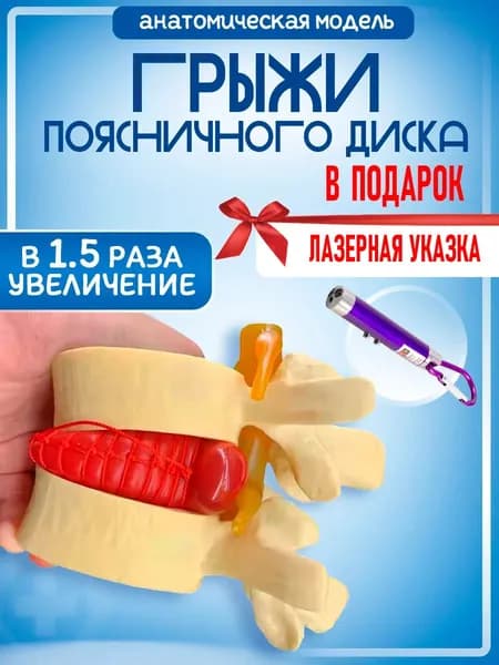 Модель грыжи поясничного диска человека, протрузия поясничного отдела позвоночника, лазер с фонариком на карабине в комплекте.