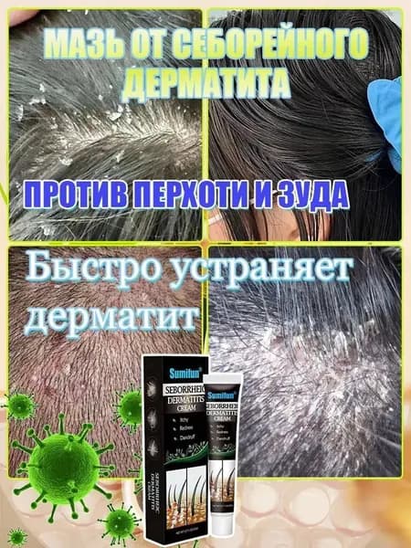 Качественный крем против себорейного дерматита, устраняющий зуд, жирность волос и шелушение, производится в объеме 20 г.