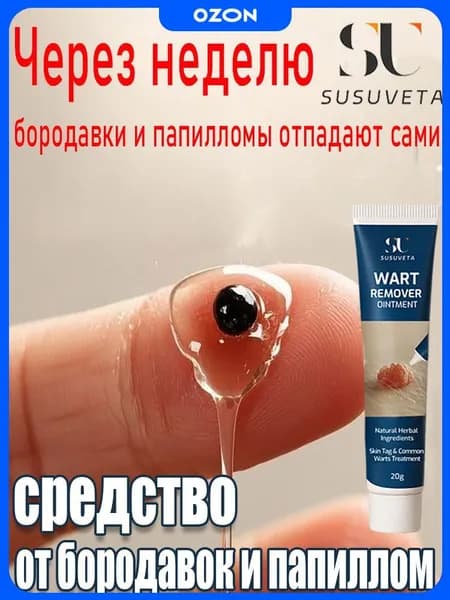 SUSUVETA Крем от папиллом и бородавок, средство для удаления новообразований. Эффективное средство для быстрого удаления папиллом и бородавок, 20 мл.