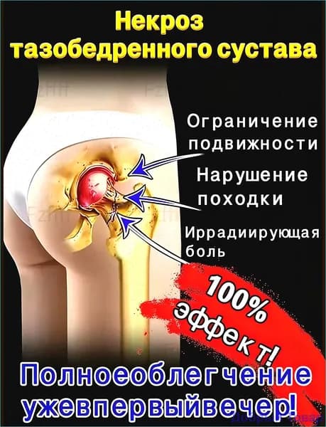 Китайский эффективный пластырь для лечения некроза тазобедренного сустава 100% 1 шт