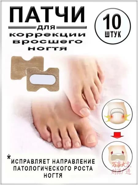 Пластыри для коррекции вросших ногтей на пальцах ног, 10 штук
