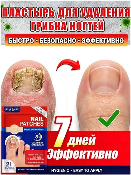 Пластыри от грибка ногтей быстро избавляют от грибковых инфекций рук и ног,а также вылечить утолщение ногтей, покраснение, отек, зуд, расслоение 21шт
