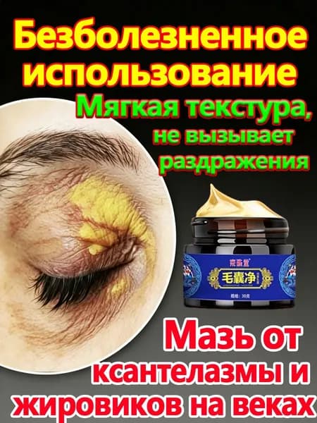 Мазь от ксантелазмы и жировиков на веках