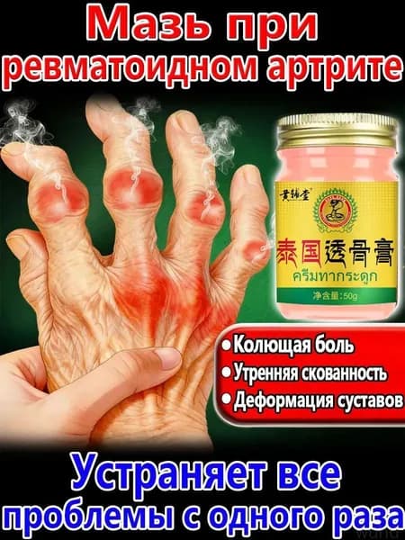 Мазь от артрита рук и ревматоидный артрит для суставов 50 r