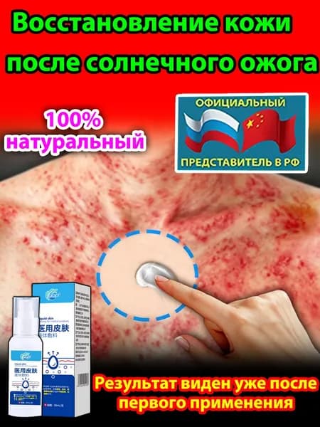 Крем для лечения солнечного дерматита,Восстановление кожи после солнечных ожогов крем после загара