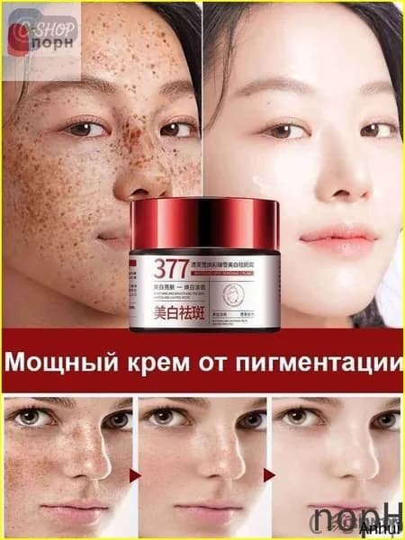 C-shop-Крем от пигментации для лица,30 г,эффективно удаляет веснушки,пигментные пятна солнечные ожоги,старческие пятна, натуральная формула с китайскими травами,восстанавливает кожу,осветляет тон кожи